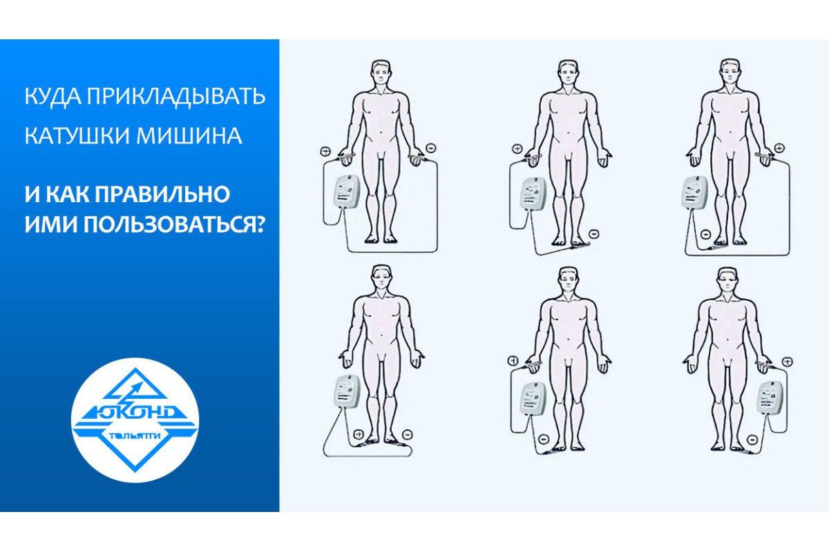 Куда прикладывать катушки Мишина и как правильно ими пользоваться?